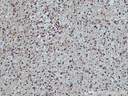 TULP3 Rabbit anti-Human, Mouse, Rat, Polyclonal, Proteintech:Antibodies:Primary