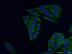 BCAT1/ECA39 Rabbit anti-Human, Mouse, Rat, Polyclonal, Proteintech 150