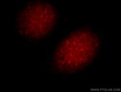 UIMC1 Rabbit anti-Human, Mouse, Polyclonal, Proteintech:Antibodies:Primary