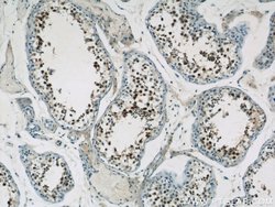 UIMC1 Rabbit anti-Human, Mouse, Polyclonal, Proteintech:Antibodies:Primary