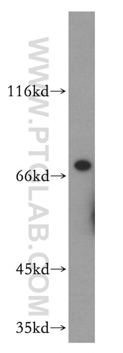 UIMC1 Rabbit anti-Human, Mouse, Polyclonal, Proteintech:Antibodies:Primary