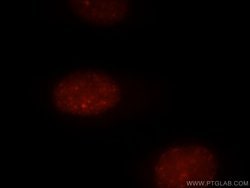 UIMC1 Rabbit anti-Human, Mouse, Polyclonal, Proteintech:Antibodies:Primary