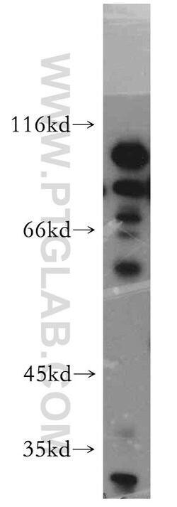 UIMC1 Rabbit anti-Human, Mouse, Polyclonal, Proteintech:Antibodies:Primary