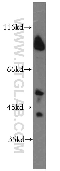 UIMC1 Rabbit anti-Human, Mouse, Polyclonal, Proteintech:Antibodies:Primary
