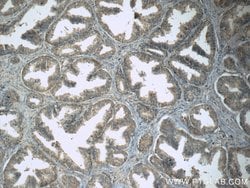 WDR19/IFT144 Rabbit anti-Human, Mouse, Rat, Polyclonal, Proteintech 150