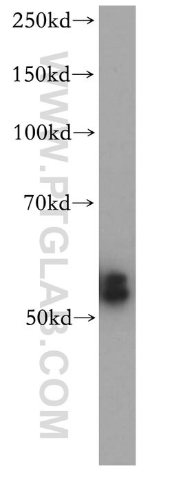 CYP2S1 Rabbit anti-Human, Mouse, Rat, Polyclonal, Proteintech 150 &mu;L;