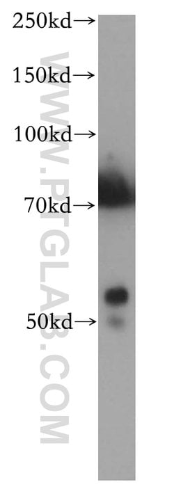 CYP2S1 Rabbit anti-Human, Mouse, Rat, Polyclonal, Proteintech 150 &mu;L;