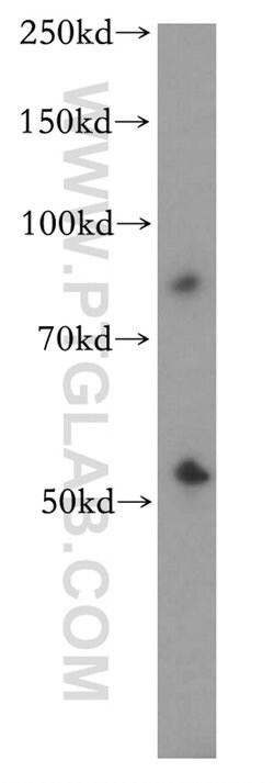 CYP2S1 Rabbit anti-Human, Mouse, Rat, Polyclonal, Proteintech 150 &mu;L;