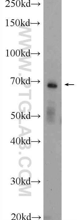 ENTPD2 Rabbit anti-Human, Mouse, Rat, Polyclonal, Proteintech:Antibodies:Primary