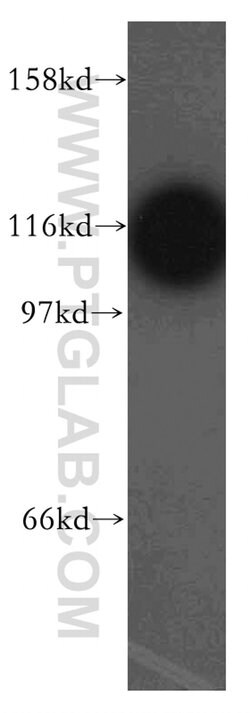 GART Rabbit anti-Human, Mouse, Rat, Polyclonal, Proteintech 150 &mu;L;