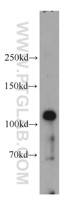 GART Rabbit anti-Human, Mouse, Rat, Polyclonal, Proteintech 150 &mu;L;