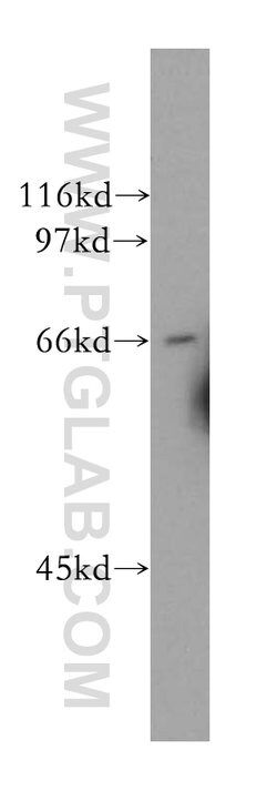 CDC14A Rabbit anti-Human, Mouse, Rat, Polyclonal, Proteintech 150 &mu;L;