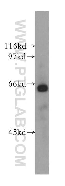 CDC14A Rabbit anti-Human, Mouse, Rat, Polyclonal, Proteintech 150 &mu;L;