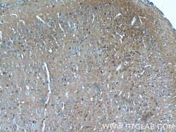 CRMP4 Rabbit anti-Human, Mouse, Rat, Polyclonal, Proteintech 150 &mu;L;