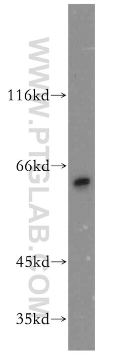 CRMP4 Rabbit anti-Human, Mouse, Rat, Polyclonal, Proteintech 150 &mu;L;