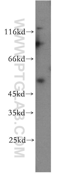 TRIM17 Rabbit anti-Human, Mouse, Rat, Polyclonal, Proteintech 150 &mu;L;