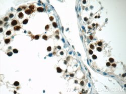 CTNNBL1 Rabbit anti-Human, Mouse, Rat, Polyclonal, Proteintech 150 &mu;L;