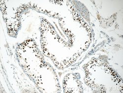 CTNNBL1 Rabbit anti-Human, Mouse, Rat, Polyclonal, Proteintech 150 &mu;L;