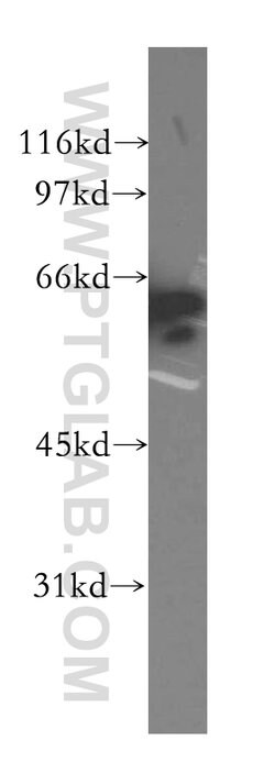 CTNNBL1 Rabbit anti-Human, Mouse, Rat, Polyclonal, Proteintech 150 &mu;L;