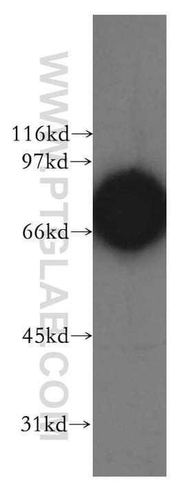 CTNNBL1 Rabbit anti-Human, Mouse, Rat, Polyclonal, Proteintech 150 &mu;L;