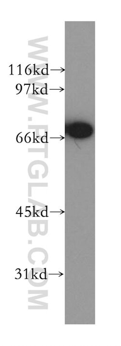CTNNBL1 Rabbit anti-Human, Mouse, Rat, Polyclonal, Proteintech 150 &mu;L;