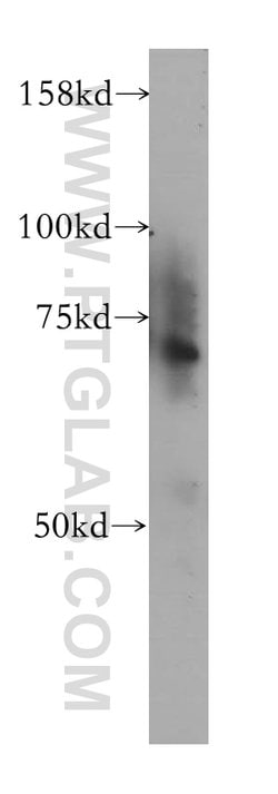 ZNF443 Rabbit anti-Human, Mouse, Polyclonal, Proteintech:Antibodies:Primary