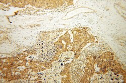 ATP11B Rabbit anti-Human, Mouse, Rat, Polyclonal, Proteintech:Antibodies:Primary