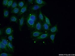 Calpain 11 Rabbit anti-Human, Mouse, Rat, Polyclonal, Proteintech:Antibodies:Primary