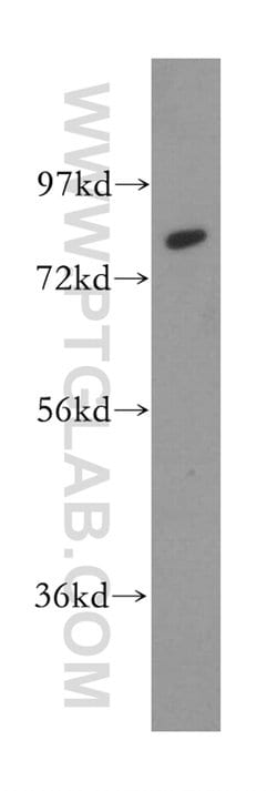 Calpain 11 Rabbit anti-Human, Mouse, Rat, Polyclonal, Proteintech:Antibodies:Primary
