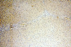 MTMR6 Rabbit anti-Human, Mouse, Rat, Polyclonal, Proteintech 150 &mu;L;
