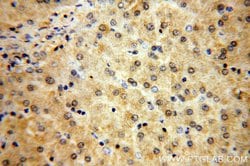 MTMR6 Rabbit anti-Human, Mouse, Rat, Polyclonal, Proteintech 150 &mu;L;