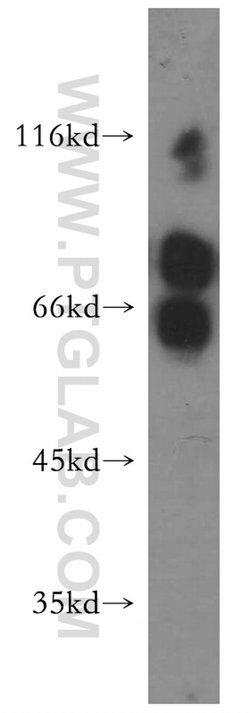 MTMR6 Rabbit anti-Human, Mouse, Rat, Polyclonal, Proteintech 150 &mu;L;