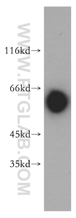 MTMR6 Rabbit anti-Human, Mouse, Rat, Polyclonal, Proteintech 150 &mu;L;