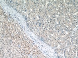 BCKDHB Rabbit anti-Human, Mouse, Rat, Polyclonal, Proteintech:Antibodies:Primary