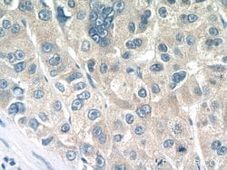 BCKDHB Rabbit anti-Human, Mouse, Rat, Polyclonal, Proteintech:Antibodies:Primary