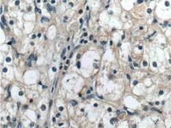 BCKDHB Rabbit anti-Human, Mouse, Rat, Polyclonal, Proteintech:Antibodies:Primary