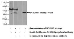 BCKDHB Rabbit anti-Human, Mouse, Rat, Polyclonal, Proteintech:Antibodies:Primary