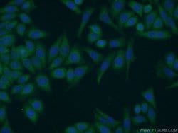 HERC4 Rabbit anti-Human, Mouse, Rat, Polyclonal, Proteintech:Antibodies:Primary