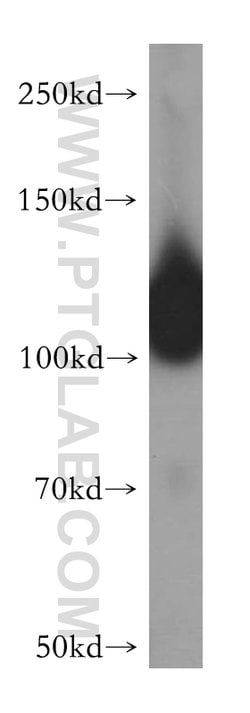 HERC4 Rabbit anti-Human, Mouse, Rat, Polyclonal, Proteintech:Antibodies:Primary