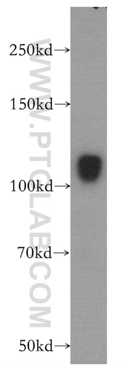 HERC4 Rabbit anti-Human, Mouse, Rat, Polyclonal, Proteintech:Antibodies:Primary