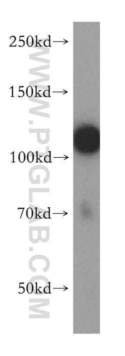 HERC4 Rabbit anti-Human, Mouse, Rat, Polyclonal, Proteintech:Antibodies:Primary