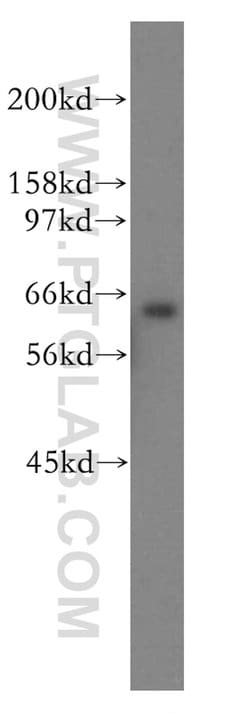 SSX2IP Rabbit anti-Human, Mouse, Rat, Polyclonal, Proteintech:Antibodies:Primary