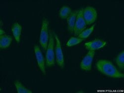 LARP1 Rabbit anti-Drosophila, Human, Mouse, Rat, Polyclonal, Proteintech