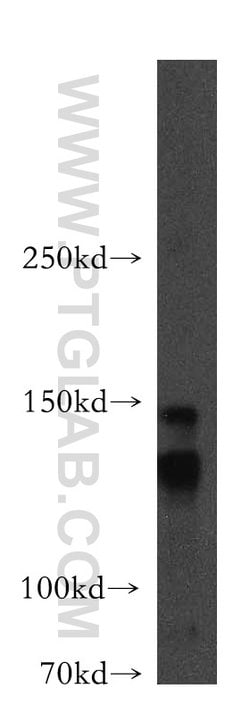 LARP1 Rabbit anti-Drosophila, Human, Mouse, Rat, Polyclonal, Proteintech