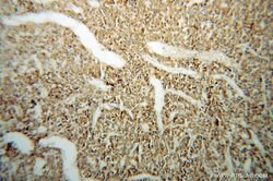 Carboxypeptidase E Rabbit anti-Human, Mouse, Rat, Polyclonal, Proteintech