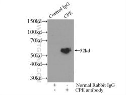 Carboxypeptidase E Rabbit anti-Human, Mouse, Rat, Polyclonal, Proteintech