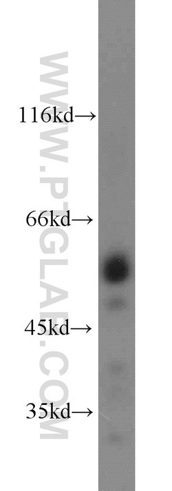 Carboxypeptidase E Rabbit anti-Human, Mouse, Rat, Polyclonal, Proteintech
