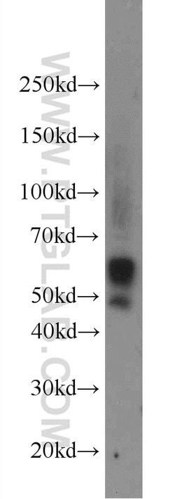 Carboxypeptidase E Rabbit anti-Human, Mouse, Rat, Polyclonal, Proteintech