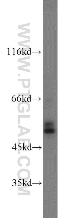 Carboxypeptidase E Rabbit anti-Human, Mouse, Rat, Polyclonal, Proteintech