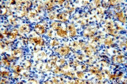 PNCK Rabbit anti-Human, Mouse, Rat, Polyclonal, Proteintech:Antibodies:Primary